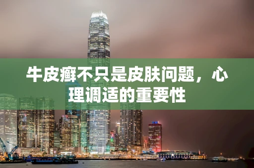 牛皮癣不只是皮肤问题，心理调适的重要性